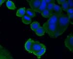 PDGF Receptor beta Antibody in Immunocytochemistry (ICC/IF)