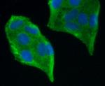 PDGF Receptor beta Antibody in Immunocytochemistry (ICC/IF)