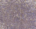 PDGF Receptor beta Antibody in Immunohistochemistry (Paraffin) (IHC (P))