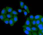 Smad2 Antibody in Immunocytochemistry (ICC/IF)