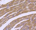 Smad2 Antibody in Immunohistochemistry (Paraffin) (IHC (P))