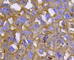 Smad2 Antibody in Immunohistochemistry (Paraffin) (IHC (P))