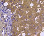 Smad2 Antibody in Immunohistochemistry (Paraffin) (IHC (P))