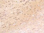 Hsc70 Antibody in Immunohistochemistry (Paraffin) (IHC (P))