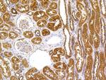 Hsc70 Antibody in Immunohistochemistry (Paraffin) (IHC (P))