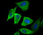 LDL Receptor Antibody in Immunocytochemistry (ICC/IF)