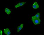 LDL Receptor Antibody in Immunocytochemistry (ICC/IF)