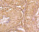 LDL Receptor Antibody in Immunohistochemistry (Paraffin) (IHC (P))