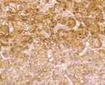 LDL Receptor Antibody in Immunohistochemistry (Paraffin) (IHC (P))