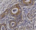 RON Antibody in Immunohistochemistry (Paraffin) (IHC (P))