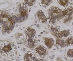 RON Antibody in Immunohistochemistry (Paraffin) (IHC (P))