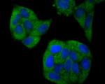 GPCR RDC1/CXCR-7 Antibody in Immunocytochemistry (ICC/IF)