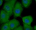 Hsc70 Antibody in Immunocytochemistry (ICC/IF)