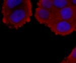 Hsc70 Antibody in Immunocytochemistry (ICC/IF)