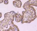 EGFR Antibody in Immunohistochemistry (Paraffin) (IHC (P))