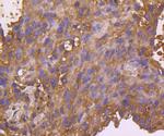 EGFR Antibody in Immunohistochemistry (Paraffin) (IHC (P))