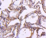 EGFR Antibody in Immunohistochemistry (Paraffin) (IHC (P))