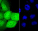 Glucocorticoid Receptor alpha Antibody in Immunocytochemistry (ICC/IF)