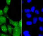 Glucocorticoid Receptor alpha Antibody in Immunocytochemistry (ICC/IF)