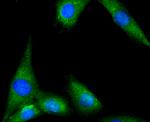 Tyrosine Hydroxylase Antibody in Immunocytochemistry (ICC/IF)