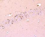 Tyrosine Hydroxylase Antibody in Immunohistochemistry (Paraffin) (IHC (P))