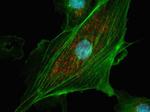 Rabbit IgG (H+L) Cross-Adsorbed Secondary Antibody in Immunocytochemistry (ICC/IF)