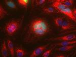 Mouse IgG (H+L) Cross-Adsorbed Secondary Antibody in Immunocytochemistry (ICC/IF)