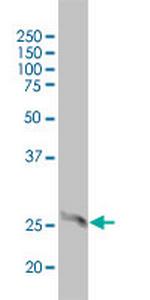 4-1BB Antibody in Western Blot (WB)