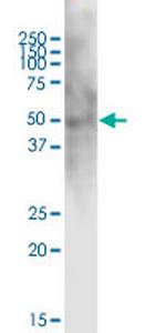 CD28 Antibody in Western Blot (WB)