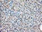 RAB17 Antibody in Immunohistochemistry (Paraffin) (IHC (P))