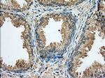 RAB17 Antibody in Immunohistochemistry (Paraffin) (IHC (P))