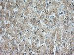 RAB17 Antibody in Immunohistochemistry (Paraffin) (IHC (P))