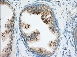 RAB17 Antibody in Immunohistochemistry (Paraffin) (IHC (P))