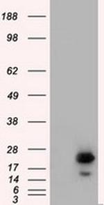 RAB17 Antibody in Western Blot (WB)