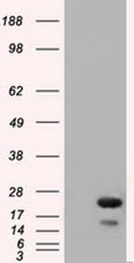 RAB17 Antibody in Western Blot (WB)