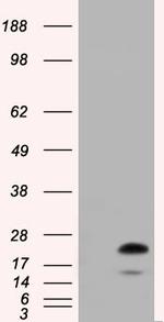 RAB17 Antibody in Western Blot (WB)