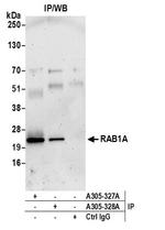 RAB1A Antibody in Immunoprecipitation (IP)