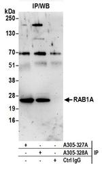 RAB1A Antibody in Immunoprecipitation (IP)