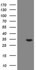 RAB20 Antibody in Western Blot (WB)