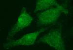 RAB21 Antibody in Immunocytochemistry (ICC/IF)