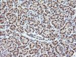 RAB21 Antibody in Immunohistochemistry (Paraffin) (IHC (P))