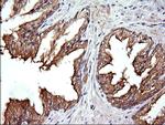 RAB21 Antibody in Immunohistochemistry (Paraffin) (IHC (P))