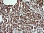 RAB21 Antibody in Immunohistochemistry (Paraffin) (IHC (P))