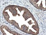 RAB21 Antibody in Immunohistochemistry (Paraffin) (IHC (P))