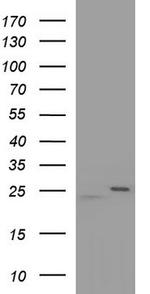 RAB21 Antibody in Western Blot (WB)