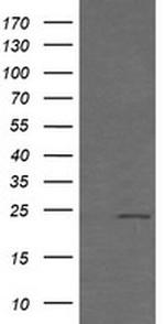 RAB21 Antibody in Western Blot (WB)