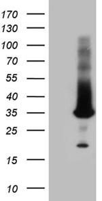 RAB23 Antibody in Western Blot (WB)