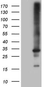 RAB23 Antibody in Western Blot (WB)