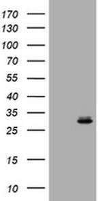 RAB24 Antibody in Western Blot (WB)