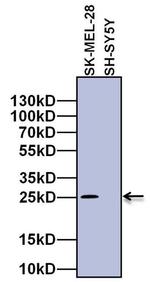 RAB27A Antibody in Western Blot (WB)